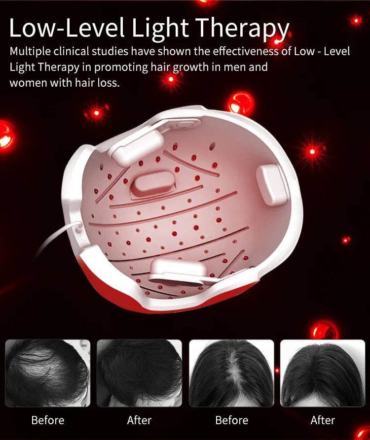 Haarwachstumshelm - Rotlichttherapie